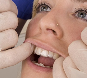 woman at Invisalign appointment